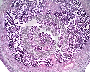 Ampulla of Fallopian tube