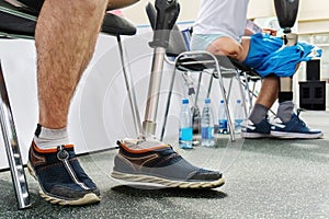 Amputees are sitting on chairs trying on new bionic prostheses. Modern technology for prosthetic limbs. Cropped frame. No face