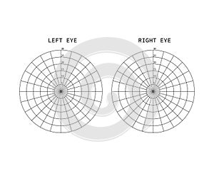 Amsler test grid. Eye scotoma chart. Oculist Vector printable chart retina examination. Grid with dot in centre. Vision control