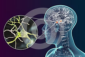 Amygdala in the brain, and closeup view of amygdala neurons, 3D illustration