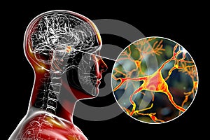 Amygdala in the brain, and closeup view of amygdala neurons, 3D illustration