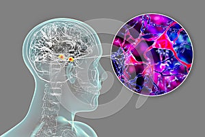 Amygdala in the brain, and closeup view of amygdala neurons, 3D illustration
