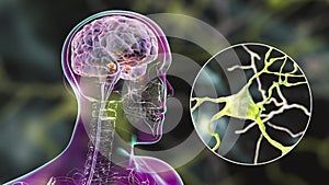 Amygdala in the brain, and closeup view of amygdala neurons, 3D illustration photo