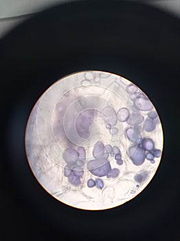 Amyloplasts: store starch. Vegetable cells view with an optic microscope.