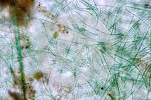 Anabaena is a genus of filamentous cyanobacteria. photo