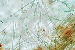 Anabaena is a type of algae under the microscopic