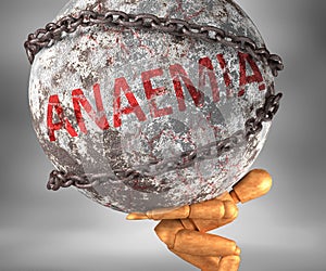 Anaemia and hardship in life - pictured by word Anaemia as a heavy weight on shoulders to symbolize Anaemia as a burden, 3d