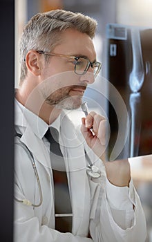 Analysis, healthcare and doctor looking at an x ray for research, body problem and medical results. Medicine, expert and
