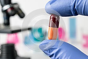 Analysis of medicaments in laboratory. Medical Research and diseases Science photo