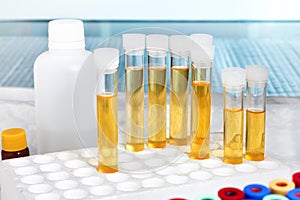 Analysis of urine in lab