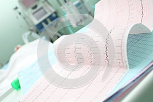 Analyzing patient's ECG in ICU