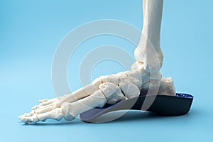 Anatomical model of the bones of the human foot wearing an orthopedic insole concept for Physical therapy for leg injury, Skeletal