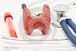 Anatomical model of thyroid gland, stethoscope and blood test results are on doctor table. Concept for the diagnosis or testing of