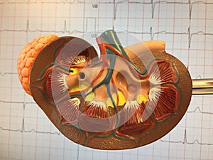 Anatomical plastic model of human kidney