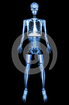 Anatomical Position. (X-ray whole body )