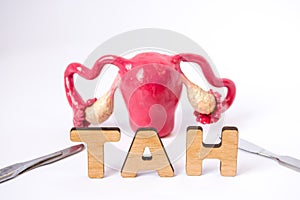 Anatomical shape of uterus with ovaries is at slightly blurred background and in foreground are the letters which form medical acr
