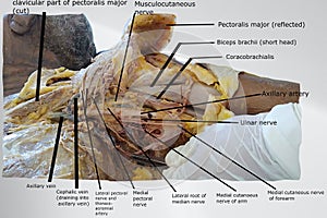 anatomical structure present in axilla region