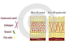 The anatomical structure   the skin. Elastin, hyaluronic acid, collagen. Skin aging, wrinkles before and after