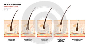 Anatomical training poster. Hair growth phase step by step. Stages of the hair growth cycle. Anagen, telogen, catagen