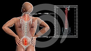 Anatomical vision back pain. Spine anatomy. 3D illustration