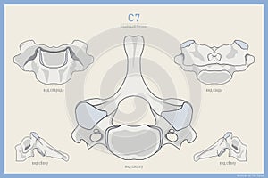 Anatomy of the 7th Cervical Vertebra on Russian. Vertebra Prominens C7. Anterior, Posterior, Lateral and Top View. Illustration