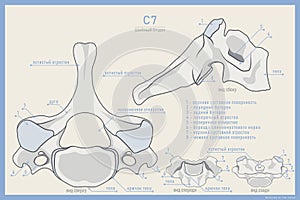 Anatomy of the 7th Cervical Vertebra on Russian. Vertebra Prominens C7. Anterior, Posterior, Lateral and Top View. Illustration