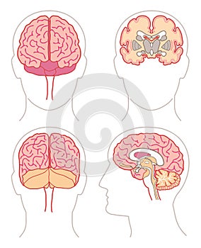 Cerebro 1 