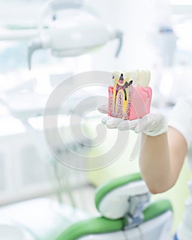 Anatomy of a dental model concept of a dentist cross section for education. The dentist holds a mock tooth in section in