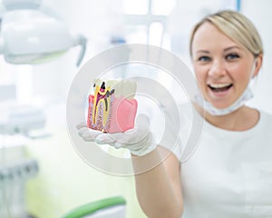 Anatomy of a dental model concept of a dentist cross section for education. Female Dentist holds a mock tooth in section