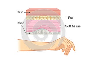 Anatomy of Human Skin layer and arm.