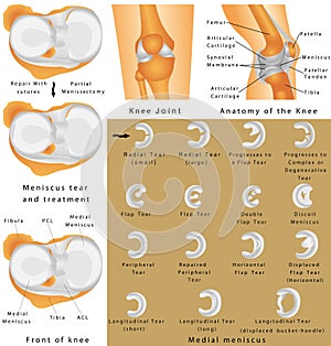 Anatomy of the Knee photo