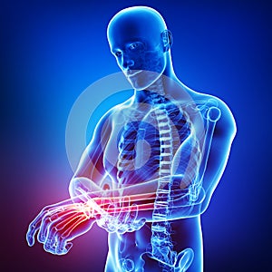 Anatomy of male hand pain