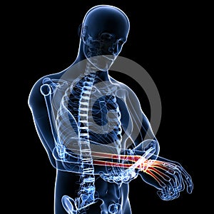 Anatomy of male wrist pain