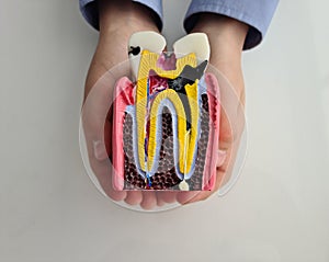 Anatomy mockup of section of tooth with caries in children hands