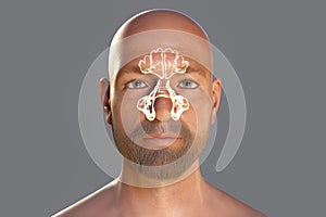 Anatomy of paranasal cavities, illustration showing paranasal sinuses highlighted on a male face