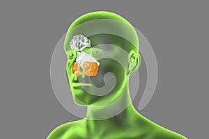 Anatomy of paranasal sinuses photo