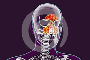 Anatomy of paranasal sinuses photo