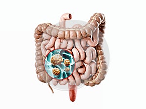 Anatomy of realistic 3d illustration of human internal organ - intestine
