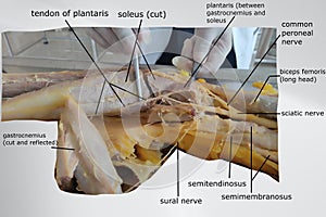 anatomy of superficial flexor muscles of the back of the leg with popliteal fossa