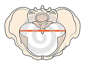 Android Pelvis Shape w Triangular / Heart shape