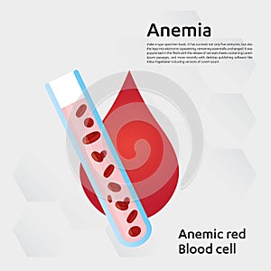 Anemia amount of red blood Iron deficiency anemia difference of Anemia amount of red blood cell and normal symptoms vector illustr