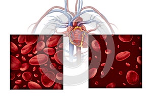 Anemia Anaemia Concept Diagram photo