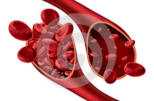 Anemia Anatomy photo