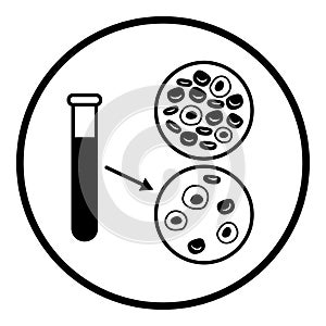 Anemia: blood test samples comparison