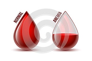 Anemia and Hemophilia icon. Drop shapes with blood level. Vector illustration