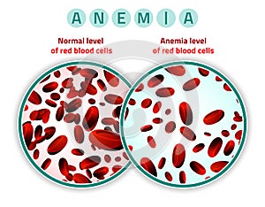 Nivel de sangre células 