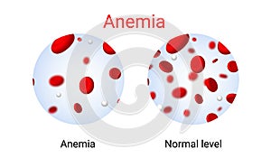 Anemia problem circulatory iron body diagram background. Anaemia biology blood isolated medical normal icon. photo