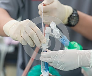 anesthesia nurse use suction suck sputum in double lumen endotracheal tube