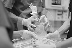 An anesthesiologist leads the patient into general anesthesia photo