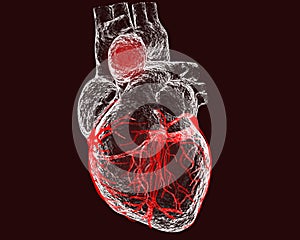 Aneurism of ascending aorta